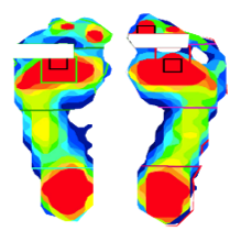 Forcemapping -FOOT足底壓力分(fèn)布(bù)測試係統 Forcemapping -FOOT足底壓力分布測試(shì)係統
